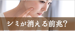 シミが消える前兆?消える前濃くなるって本当?顔のシミを自分で取る方法